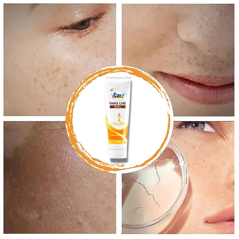 acne scar removal gel